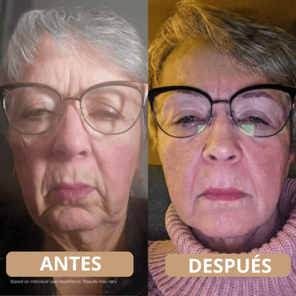 Sistema de Micro-Infusión