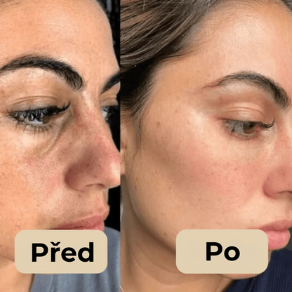 Korejský Peel Shot – Odstraňuje nečistoty a dodává pleti dokonalý vzhled