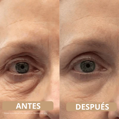 Sistema de Micro-Infusión