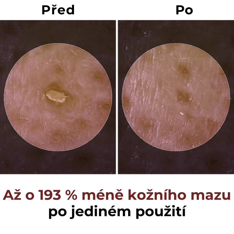 Korejský Peel Shot – Odstraňuje nečistoty a dodává pleti dokonalý vzhled