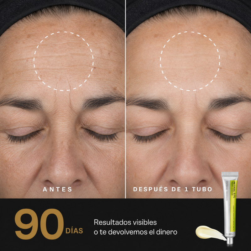 Vireli Retinal 0,1%
