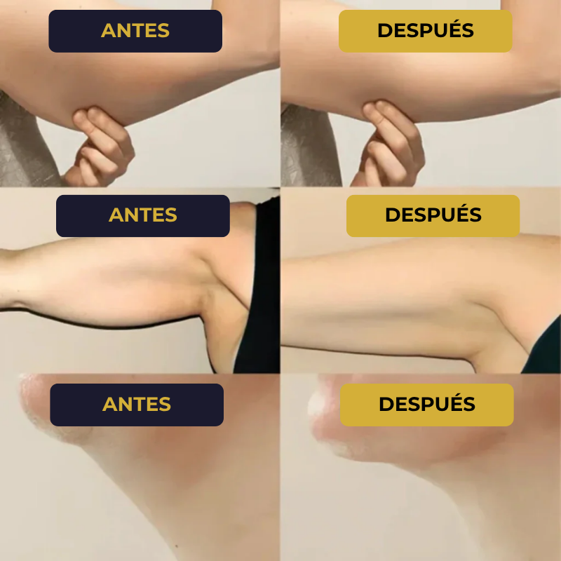 Drenante Linfático