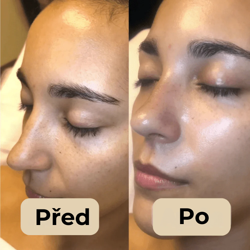 Korejský Peel Shot – Odstraňuje nečistoty a dodává pleti dokonalý vzhled