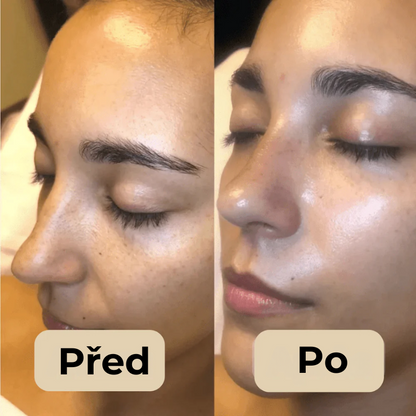 Korejský Peel Shot – Odstraňuje nečistoty a dodává pleti dokonalý vzhled