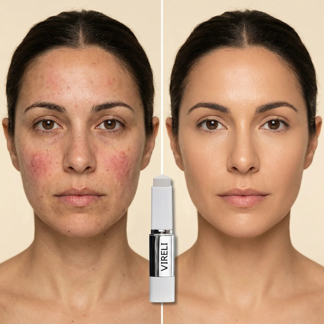 Antes y después VIRELI FDT Stick — resultados reales sin filtros